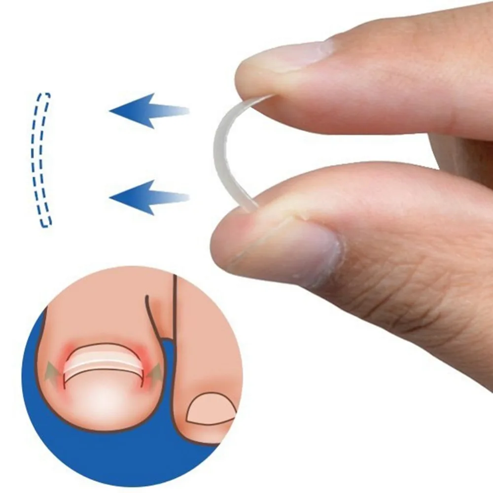 10Pcs Ingrown Toenail Correction Tool Ingrown Toe Nail Treatment Elastic Patch Sticker Straightening Clip Brace Pedicure Tools
10Pcs Ingrown Toenail Correction Tool Ingrown Toe Nail Treatment Elastic Patch Sticker Straightening Clip Brace Pedicure Tools
