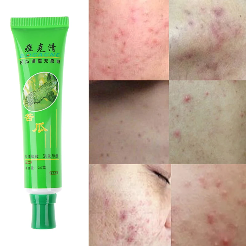 Natural Aloe Vera Gel Wrinkle Removal Moisturizing Anti Acne Anti-sensitive Oil-Control New
Natural Aloe Vera Gel Wrinkle Removal Moisturizing Anti Acne Anti-sensitive Oil-Control New