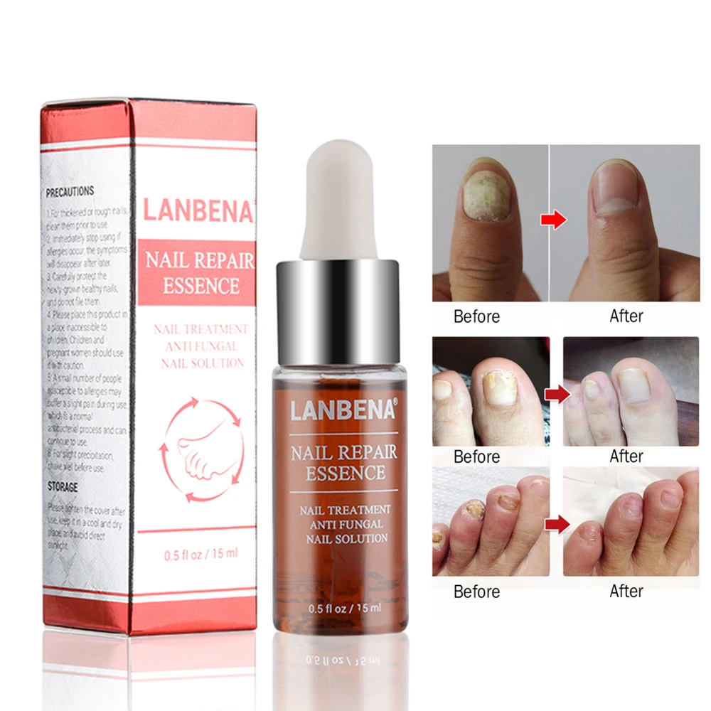 15ml Nail Fungal Treatment Liquid Anti Fungus Removal Onychomycosis Toenail Care Nail Repair Liquid Anti Infection Foot Caring
15ml Nail Fungal Treatment Liquid Anti Fungus Removal Onychomycosis Toenail Care Nail Repair Liquid Anti Infection Foot Caring