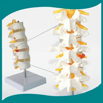 Life Size 5 Section Human Lumbar Model Spine with Caudal Equina Nerve Lumbar Spine Disc Model Spine Chiropractic Skeleton Model
Life Size 5 Section Human Lumbar Model Spine with Caudal Equina Nerve Lumbar Spine Disc Model Spine Chiropractic Skeleton Model