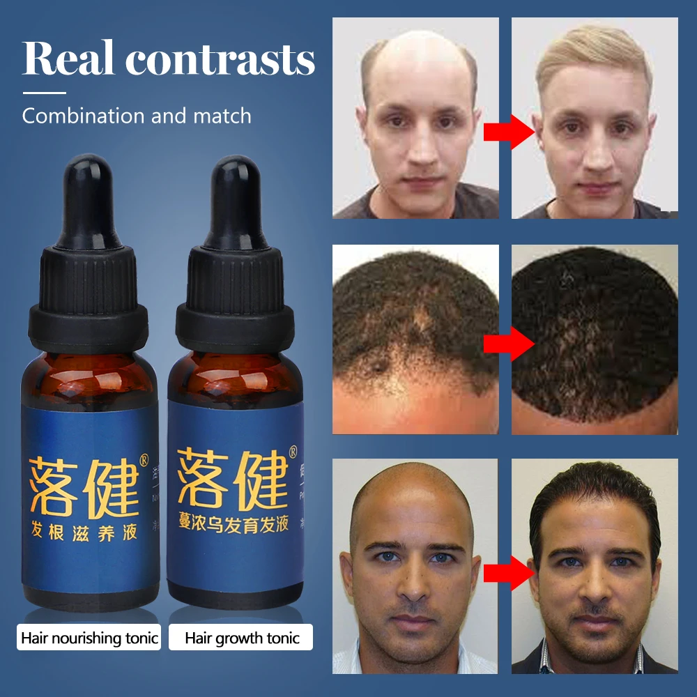 Hair Growth Essence Oil for Hair Growth Treatment Anti hair Loss Product Natural Herbal Nourishing Hair Care Products Hair Serum
Hair Growth Essence Oil for Hair Growth Treatment Anti hair Loss Product Natural Herbal Nourishing Hair Care Products Hair Serum