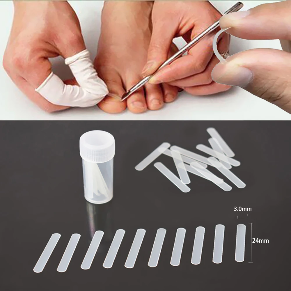 10pc Ingrown Toenail Correction Tool Pedicure Tools A Incarnated Curve Runner bunion Corrector Foot Care Tool nail Straightening
10pc Ingrown Toenail Correction Tool Pedicure Tools A Incarnated Curve Runner bunion Corrector Foot Care Tool nail Straightening