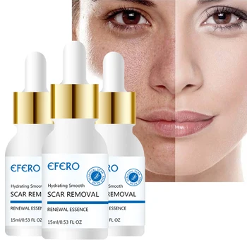 EFERO 3pcs Acne Treatment Essence Skin Care Repair Serum for Face Firming Shrink Pores Whitening Cream Moisturizing Skin Care
EFERO 3pcs Acne Treatment Essence Skin Care Repair Serum for Face Firming Shrink Pores Whitening Cream Moisturizing Skin Care