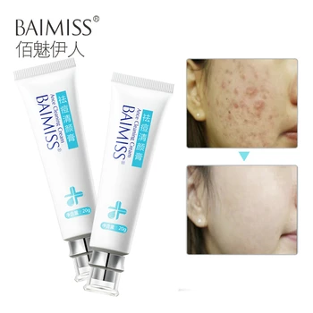 2pcs Acne Cream Acne Treatment Skin Care Comedone Pimple Acne Remover Face Anti Acne Repair Cream Herbal Cleansing
2pcs Acne Cream Acne Treatment Skin Care Comedone Pimple Acne Remover Face Anti Acne Repair Cream Herbal Cleansing