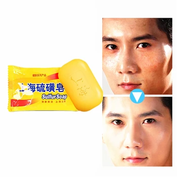 Powerful 85g Shanghai Sulfur Soap high Efficient anti itching,dandruff,acne soap for Skin care,Bath soap bubbles antifungal
Powerful 85g Shanghai Sulfur Soap high Efficient anti itching,dandruff,acne soap for Skin care,Bath soap bubbles antifungal