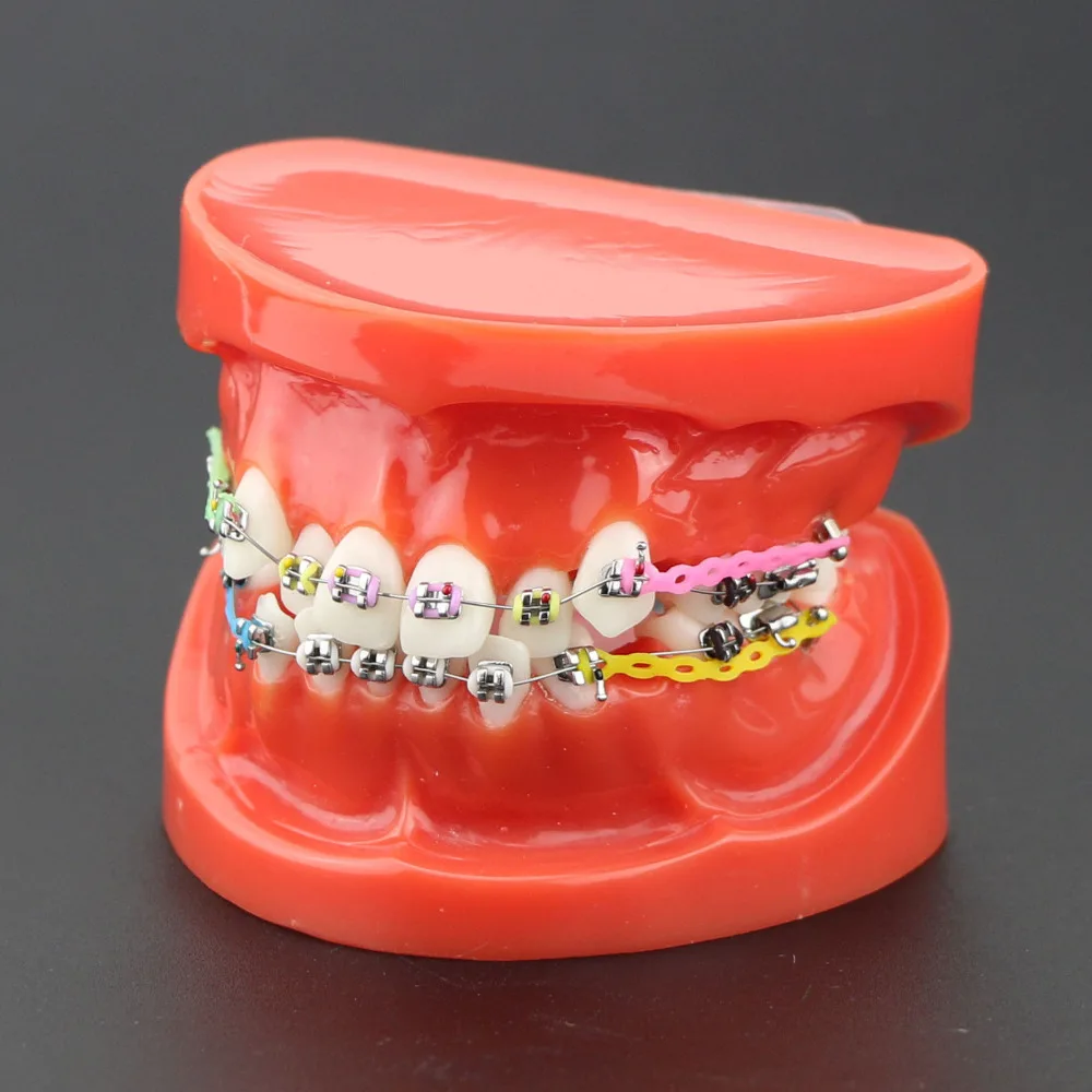 Orthodontic Model 28 Unit Teeth With Half Metal Bracket And Half Ceramic For School Training Study And Communicate With Patients
Orthodontic Model 28 Unit Teeth With Half Metal Bracket And Half Ceramic For School Training Study And Communicate With Patients
