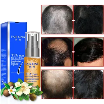 Hair Growth Essence Product Treatment Anti-Hair Loss Products Thick Hair Fast Growing Tea Tree Essential oil 20ml
Hair Growth Essence Product Treatment Anti-Hair Loss Products Thick Hair Fast Growing Tea Tree Essential oil 20ml