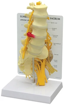 lumbar model Spinal nerve model caudal equina nerve lumbar spine disc model Spine Chiropractic skeleton model
lumbar model Spinal nerve model caudal equina nerve lumbar spine disc model Spine Chiropractic skeleton model