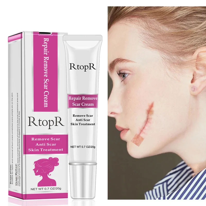 RtopR Acne Scar Stretch Marks Remover Cream Skin Repair Face Cream Acne Spot Treatment Blackhead Whitening Cream Skin Care TSLM2
RtopR Acne Scar Stretch Marks Remover Cream Skin Repair Face Cream Acne Spot Treatment Blackhead Whitening Cream Skin Care TSLM2