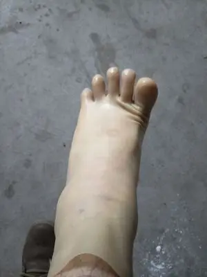 1(6)