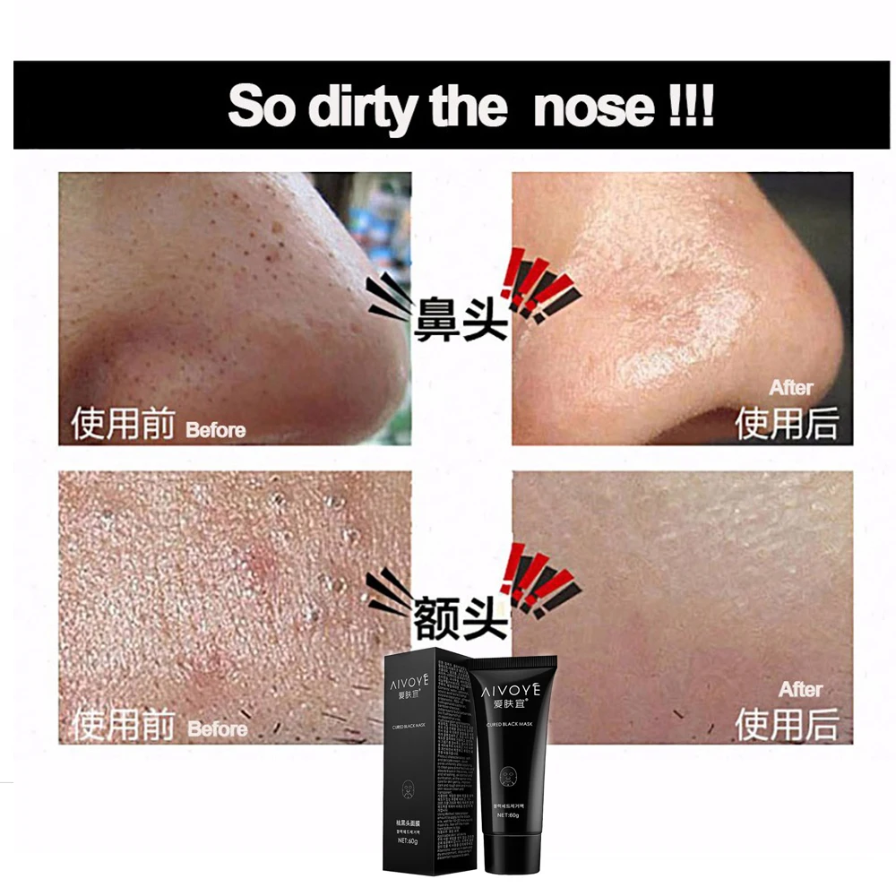 AFY NEW suction black mask Love the skin should be black mask Remove acne remove blackheads
AFY NEW suction black mask Love the skin should be black mask Remove acne remove blackheads
