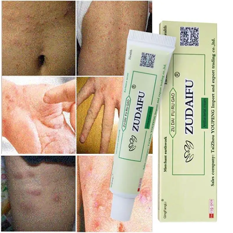 ZUDAIFU Eczema Pruritus Psoriasis Ointment herbal cream exclusive formula for psoriasis eczema itching cream paste 15g L3
ZUDAIFU Eczema Pruritus Psoriasis Ointment herbal cream exclusive formula for psoriasis eczema itching cream paste 15g L3