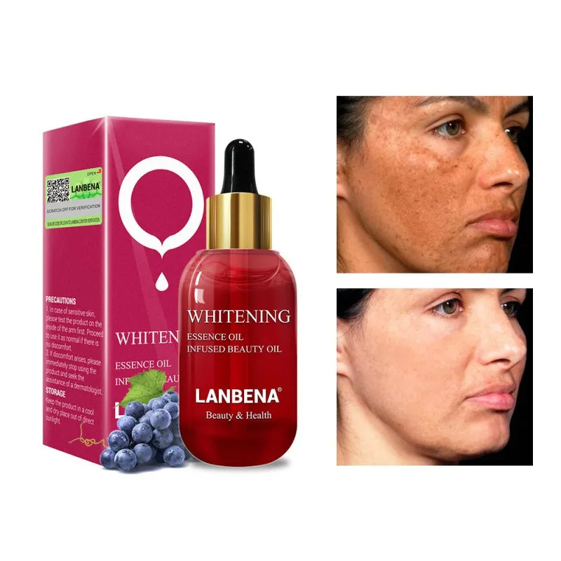New Arrival 15ml Vitamin C Whitening Essential Oil Serum Remover Face Speckle Fade Dark Spots
New Arrival 15ml Vitamin C Whitening Essential Oil Serum Remover Face Speckle Fade Dark Spots