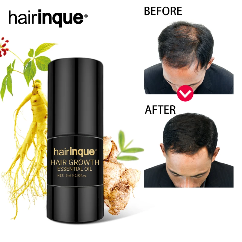 Hairinque 15ml Ginger extract Hair Growth Essence Oil Prevents hair loss supports healthy hair growth hair care oil 3.28 sale
Hairinque 15ml Ginger extract Hair Growth Essence Oil Prevents hair loss supports healthy hair growth hair care oil 3.28 sale