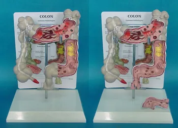 Colon structure model morbid large intestine display human digestive tract anorectal rectal model duodenum
Colon structure model morbid large intestine display human digestive tract anorectal rectal model duodenum