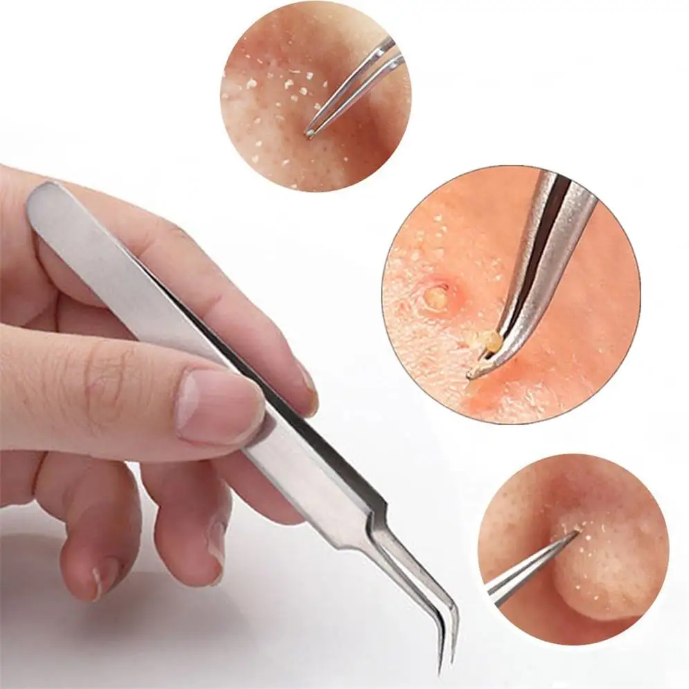 New Arrival 1PCS acne clip facial pimple comedone curved straight blackhead tweezer set stainless steel
New Arrival 1PCS acne clip facial pimple comedone curved straight blackhead tweezer set stainless steel