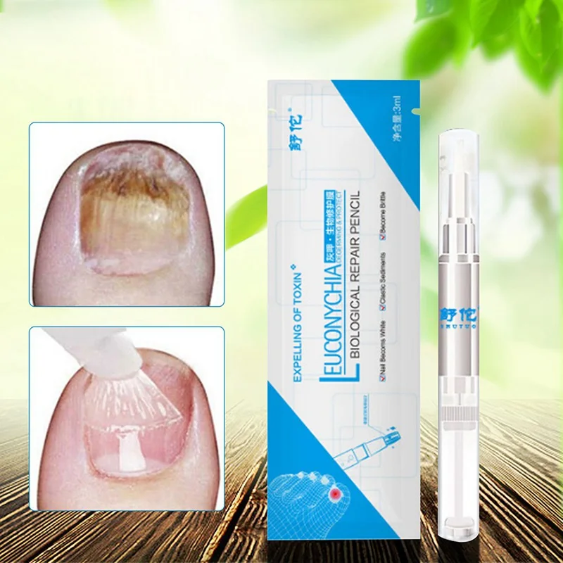 3ML Anti Fungal Treatment Nail Pen Onychomycosis Paronychia Infection Herbal Toe Finger Nails Health Beauty Accessories
3ML Anti Fungal Treatment Nail Pen Onychomycosis Paronychia Infection Herbal Toe Finger Nails Health Beauty Accessories