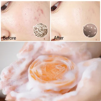 100g Long Lasting Natural Horse Oil Oil-controlling Refreshing Whitening Hydrating Moisturizing Soap Facial Care
100g Long Lasting Natural Horse Oil Oil-controlling Refreshing Whitening Hydrating Moisturizing Soap Facial Care