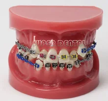 teeth Orthodontic Model Bracket arch wire with wax dental model tooth model with metal brace free shipping
teeth Orthodontic Model Bracket arch wire with wax dental model tooth model with metal brace free shipping