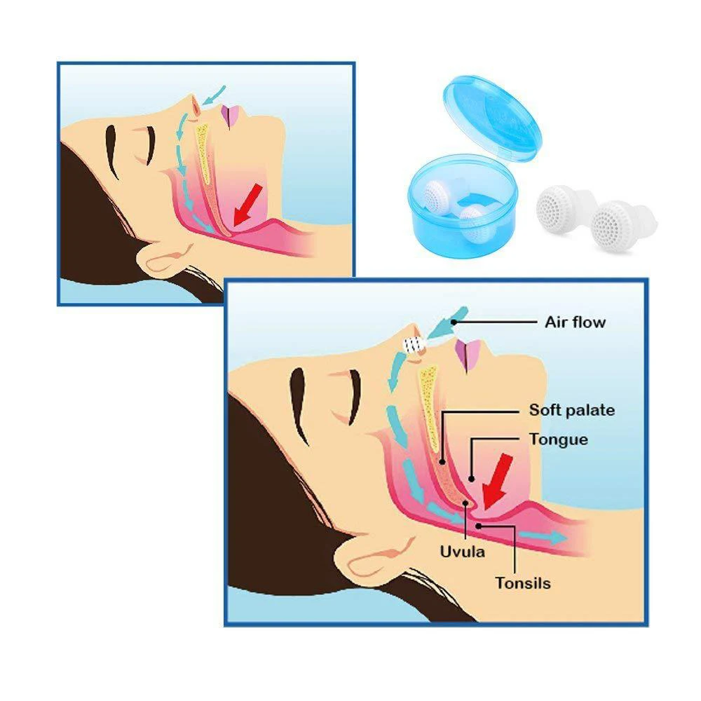 Pro Portable Anti-snoring Device Nasal Respirator Nose Clip Anti-snoring Device Snoring Air Ventilation Nose Purifier
Pro Portable Anti-snoring Device Nasal Respirator Nose Clip Anti-snoring Device Snoring Air Ventilation Nose Purifier