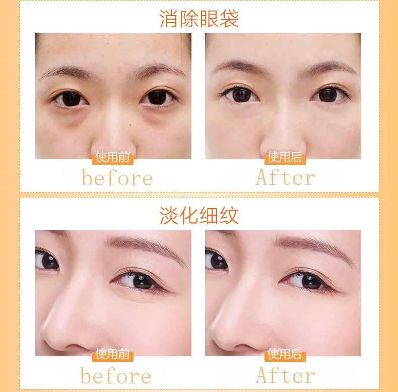 vit c for under eyes