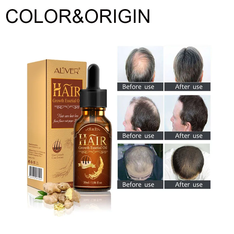 Powerful Hair Growth Essential Oil Hair Loss Products Essence Liquid Hair Faster Regrowth Treatment Hair Care Product 30 Ml
Powerful Hair Growth Essential Oil Hair Loss Products Essence Liquid Hair Faster Regrowth Treatment Hair Care Product 30 Ml