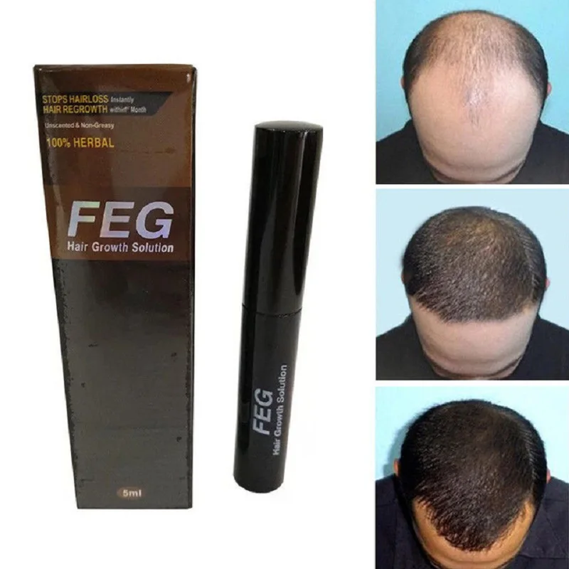 Zhenduo Hair Growth Solution Faster Grow Essence Liquid Stop Hair Loss Herbal Cure Pen
Zhenduo Hair Growth Solution Faster Grow Essence Liquid Stop Hair Loss Herbal Cure Pen