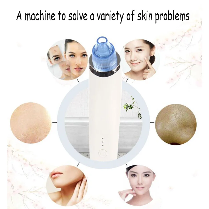 Blackhead Vacuum Cleaner Suction Removal Scar Acne Pore Peeling Face Clean Facial Skin Care Beauty Machine
Blackhead Vacuum Cleaner Suction Removal Scar Acne Pore Peeling Face Clean Facial Skin Care Beauty Machine