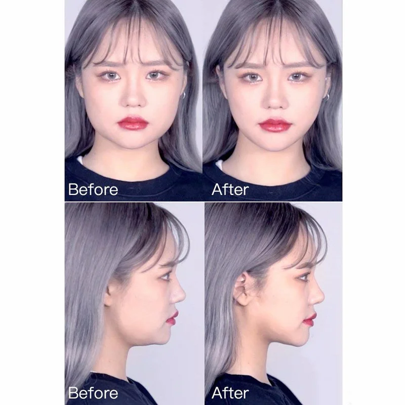 Wholesale 40pcs V-Shape Face Lift Tape Label Adhesive Makeup Fast Chin Face Lift Up Beauty Tools V Line Face Tape Dropshipping
Wholesale 40pcs V-Shape Face Lift Tape Label Adhesive Makeup Fast Chin Face Lift Up Beauty Tools V Line Face Tape Dropshipping