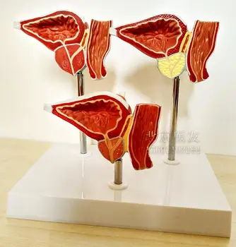 Prostate pathology teaching model Prostate lesions anatomy education teaching model
Prostate pathology teaching model Prostate lesions anatomy education teaching model
