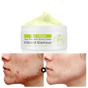 30g Tea Tree Acne Treatment Face Cream Oil Control Acne Scar Remover Shrink Pores Facial Eliminates Repair Cream
30g Tea Tree Acne Treatment Face Cream Oil Control Acne Scar Remover Shrink Pores Facial Eliminates Repair Cream