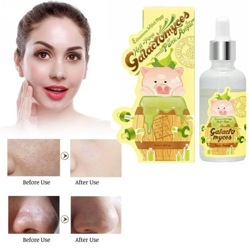 Cute Piggy Facial Essence Serum Shrink Pore Control Hyaluronic Acid Moisturizing Face Skin Care Serum Ageless Anti Winkles Serum
Cute Piggy Facial Essence Serum Shrink Pore Control Hyaluronic Acid Moisturizing Face Skin Care Serum Ageless Anti Winkles Serum