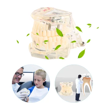 Adult Removable Teeth Model Professional Transparent Dental Implantation Disease Teeth Model Teaching Teeth Tool Dental
Adult Removable Teeth Model Professional Transparent Dental Implantation Disease Teeth Model Teaching Teeth Tool Dental