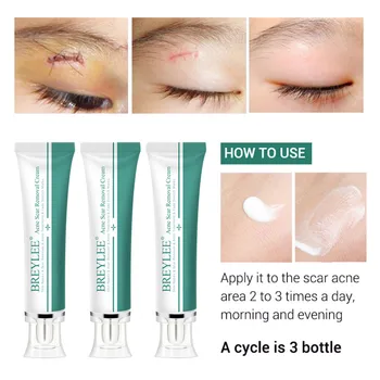 BREYLEE 30g Remove Stretch Marks Whitening Cream Acne Scar Removal Cream Face Cream Skin Repair Skin Care Scar Acne Treatment
BREYLEE 30g Remove Stretch Marks Whitening Cream Acne Scar Removal Cream Face Cream Skin Repair Skin Care Scar Acne Treatment