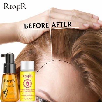 Moroccan Hair Essential Oil + Herbal Hair Growth Thick Essential Oil Set Anti-hair loss Hair care Nourishing luster Big set 
Moroccan Hair Essential Oil + Herbal Hair Growth Thick Essential Oil Set Anti-hair loss Hair care Nourishing luster Big set