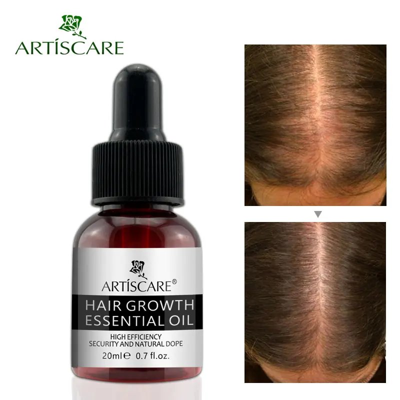 ARTISCARE Hair Growth Essential Oil Anti Hair Loss Liquid Hair Repair Treatment Dense for Women Men Hair Serum
ARTISCARE Hair Growth Essential Oil Anti Hair Loss Liquid Hair Repair Treatment Dense for Women Men Hair Serum