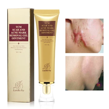 LANBENA Acne Scar Removal Cream Against Black Dots Scar Removal Facial Blackhead Acne Treatment
LANBENA Acne Scar Removal Cream Against Black Dots Scar Removal Facial Blackhead Acne Treatment