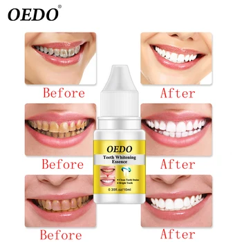 Teeth Whitening Essence Powder Oral Hygiene Cleaning Serum Removes Plaque Stains Tooth Bleaching Dental Tools Toothpaste
Teeth Whitening Essence Powder Oral Hygiene Cleaning Serum Removes Plaque Stains Tooth Bleaching Dental Tools Toothpaste