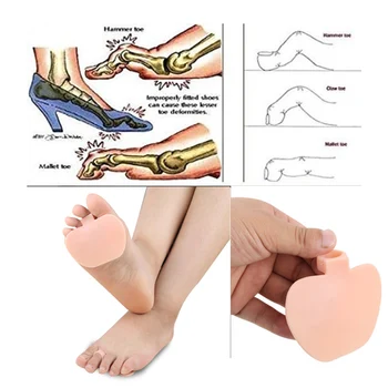 2Pcs Silicone Gel Orthopedic Metatarsal Rings Hammer Toe Separator Correction Straightener Feet Care Shoes Cushion Pads Z32601
2Pcs Silicone Gel Orthopedic Metatarsal Rings Hammer Toe Separator Correction Straightener Feet Care Shoes Cushion Pads Z32601