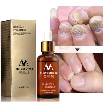 Meiyanqiong Herbal Nail Fungus Treatment Essential Oil Foot Protector Skin Nail Care Essential Oil Nail Repair Essential 30ml
Meiyanqiong Herbal Nail Fungus Treatment Essential Oil Foot Protector Skin Nail Care Essential Oil Nail Repair Essential 30ml
