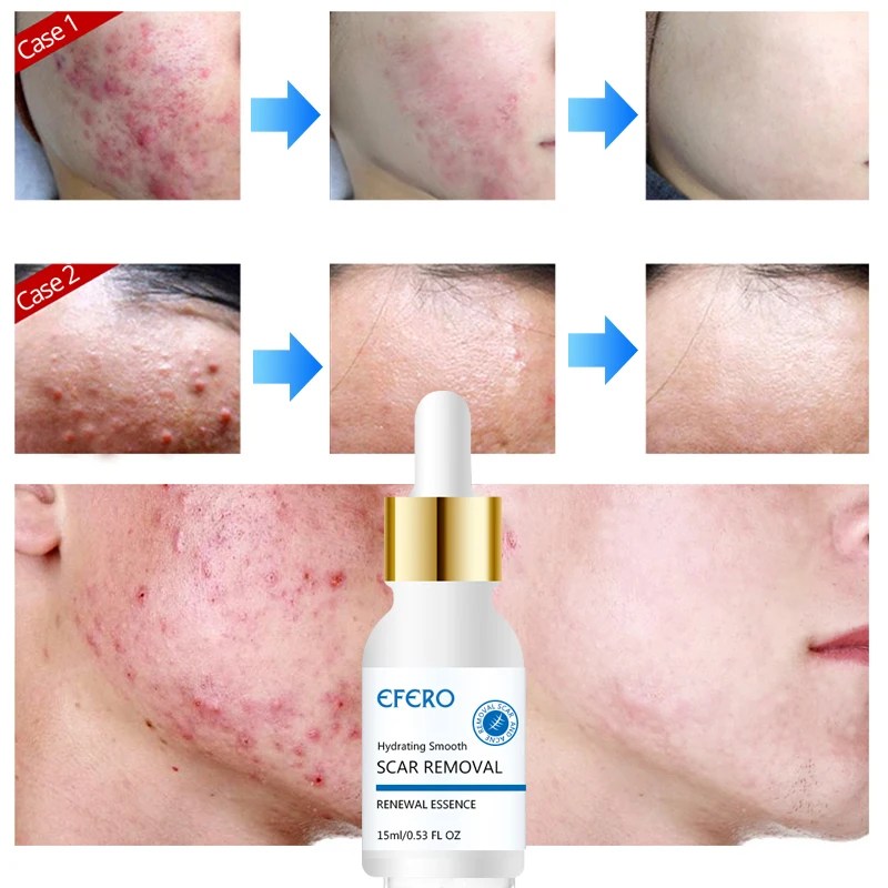 7 (2)