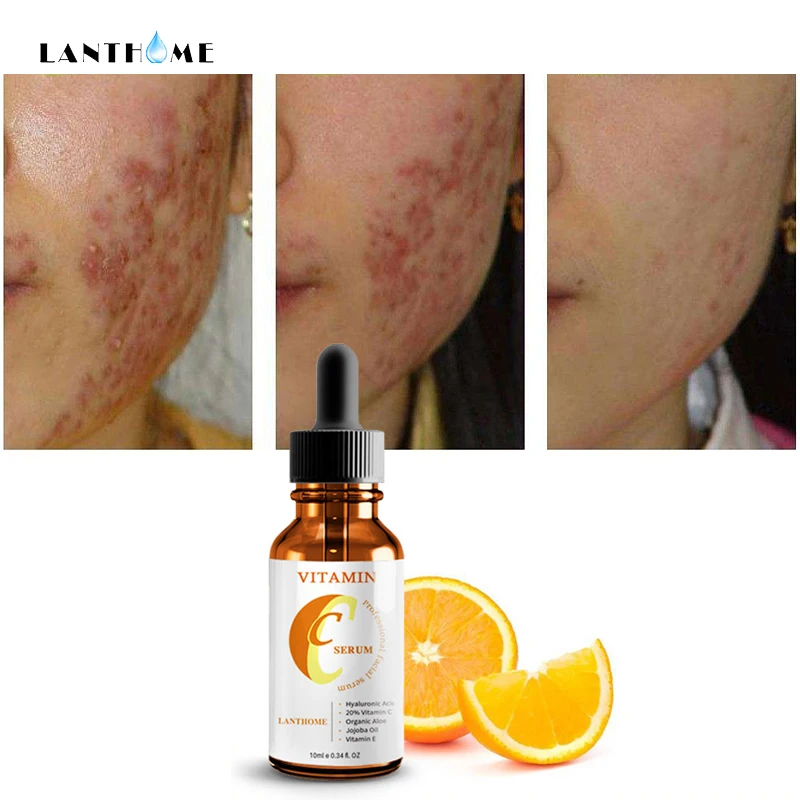 Lanthome Anti-Aging Whitening Vitamin C Moist Hyaluronic Acid Face Serum Anti Wrinkle Firming Essence Serum Pigment Age Spots
Lanthome Anti-Aging Whitening Vitamin C Moist Hyaluronic Acid Face Serum Anti Wrinkle Firming Essence Serum Pigment Age Spots