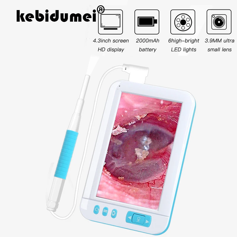 3.9MM Len 1080P Otoscope P20 Endoscope Camera Kit Ear Spoon Cleaning 4.3" HD Screen Mini Ear Protector Picker Tool Health Care
3.9MM Len 1080P Otoscope P20 Endoscope Camera Kit Ear Spoon Cleaning 4.3" HD Screen Mini Ear Protector Picker Tool Health Care