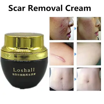 BellyLady 50g Scar Removal Cream Acne Treatment Cream Cell Repair Factor Skin Care
BellyLady 50g Scar Removal Cream Acne Treatment Cream Cell Repair Factor Skin Care
