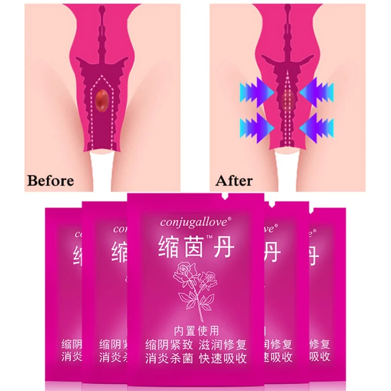 Firming Lifting Vaginal Contraction Gel Moisturizing Tightening Vaginal Relieve Dryness Privates Care Product Intimate Hygiene
Firming Lifting Vaginal Contraction Gel Moisturizing Tightening Vaginal Relieve Dryness Privates Care Product Intimate Hygiene