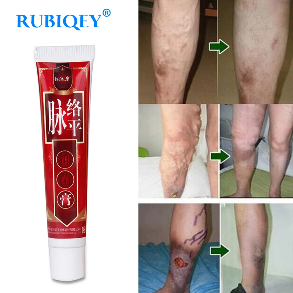 4Pcs Varicose Veins Treatment Cream Ointment Vasculitis Phlebitis Spider Veins Pain Varicosity Angiitis Remedy Removal Cream
4Pcs Varicose Veins Treatment Cream Ointment Vasculitis Phlebitis Spider Veins Pain Varicosity Angiitis Remedy Removal Cream