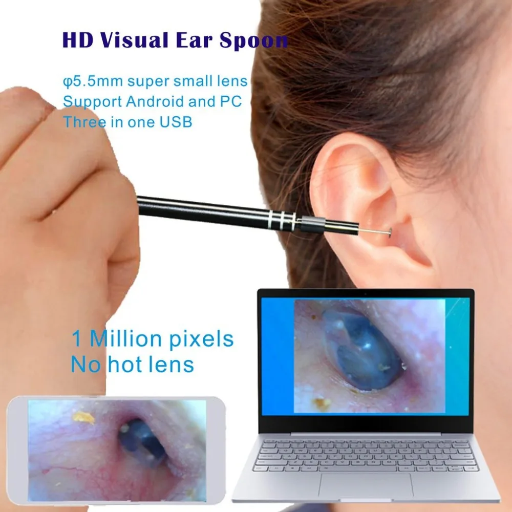 2 In 1 Multifunctional USB Ear Cleaning Tool HD Visual Ear Spoon Earpick With Mini Camera Ear Care Cleaning Tools
2 In 1 Multifunctional USB Ear Cleaning Tool HD Visual Ear Spoon Earpick With Mini Camera Ear Care Cleaning Tools