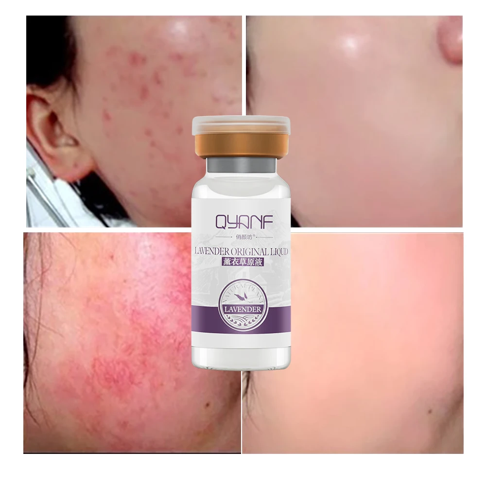QYF 100% Pure Plant Extract Lavender Serum Essence Moisturizing Removes Facial Scar Acne Pigment Hyaluronic Acid Face Skin Care
QYF 100% Pure Plant Extract Lavender Serum Essence Moisturizing Removes Facial Scar Acne Pigment Hyaluronic Acid Face Skin Care