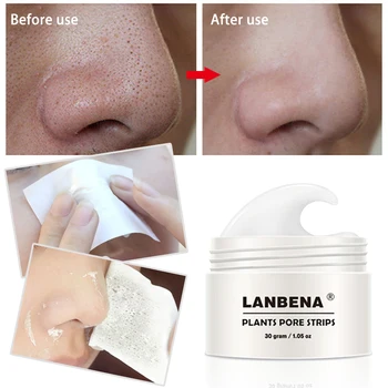 Style LANBENA Blackhead Remover Nose Pore Strip Black Mask Peeling Acne Treatment