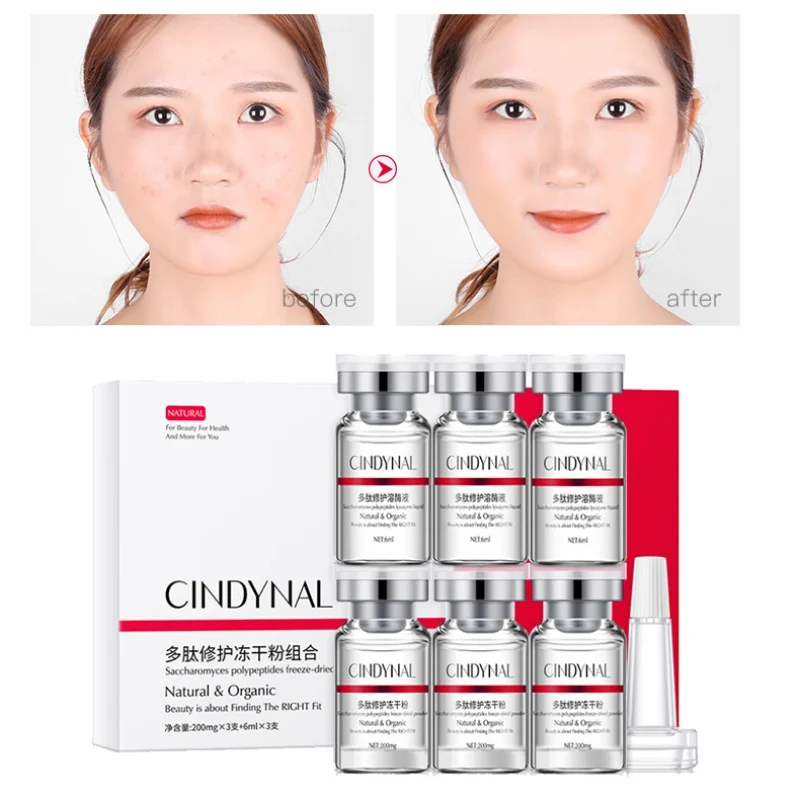 Peptide Repair Lyophilized Powder Lysozyme Solution Set Moisturizing Anti-Acne Oil-Control Efg Serum
Peptide Repair Lyophilized Powder Lysozyme Solution Set Moisturizing Anti-Acne Oil-Control Efg Serum